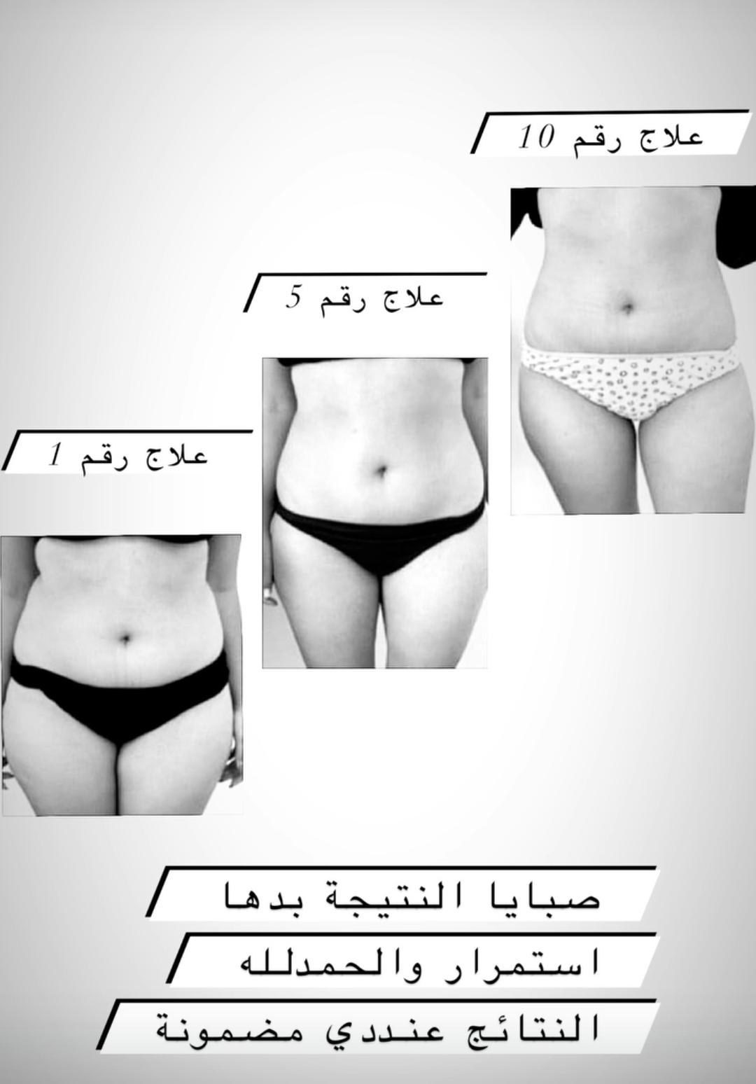 Body Transformation