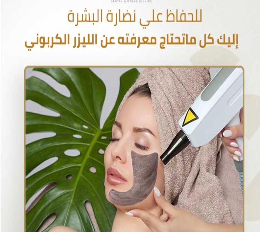 Carbon Laser Peel