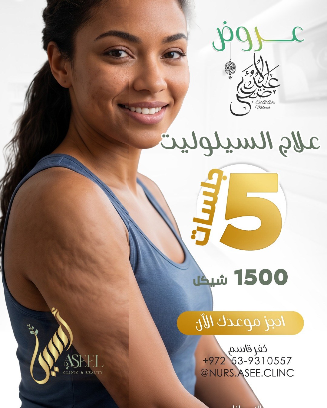 Cellulite Treatment