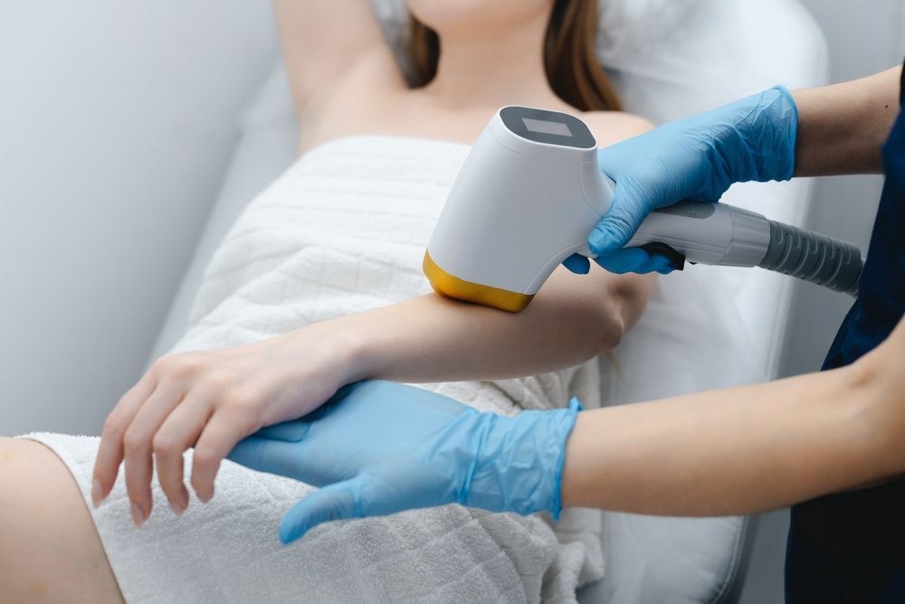 Laser Hair Removal — Women